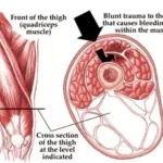 Acompanhamento Médico