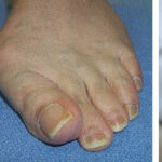 Cirurgia Reconstrutiva do tornozelo e pé 2