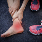 Cirurgia Reconstrutiva do tornozelo e pé 6