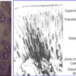 Artroscopia do Joelho