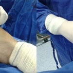 Técnica Cirúrgica 3