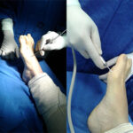 Técnica Cirúrgica 4