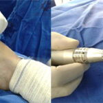 Técnica Cirúrgica 5